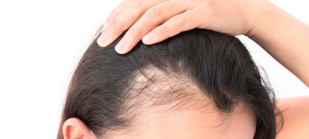 faqs | laser hair restoration | hair replacement systems