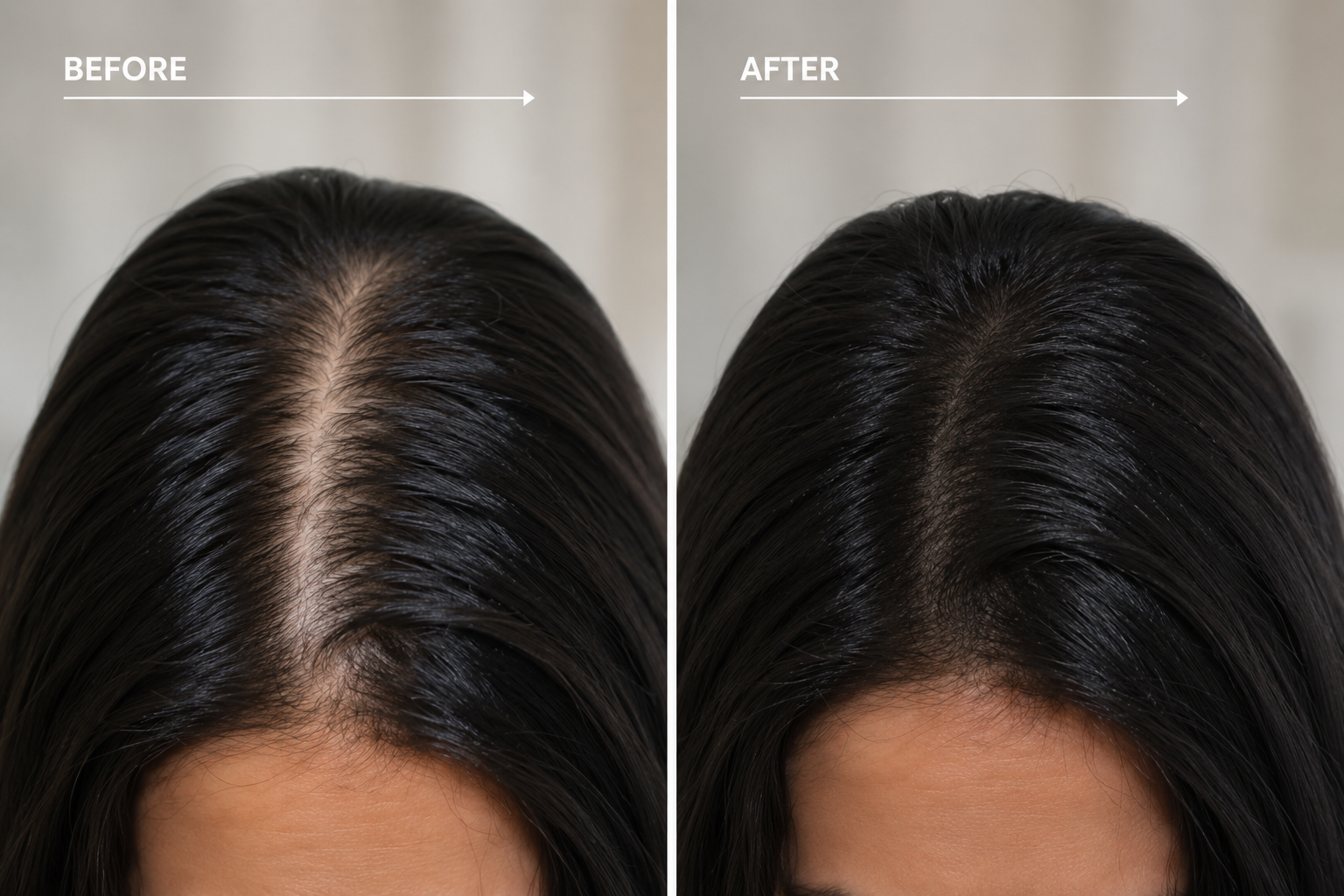 Before and after Scalp Micropigmentation for female thinning hair and hair loss.